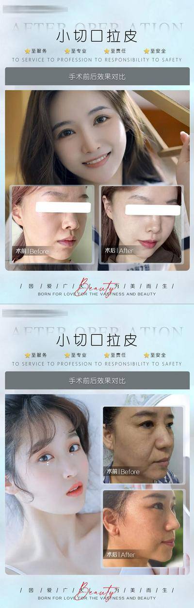 【南门网dcpsd.com】海报 医美 整形 美业 美容 案例 对比 系列