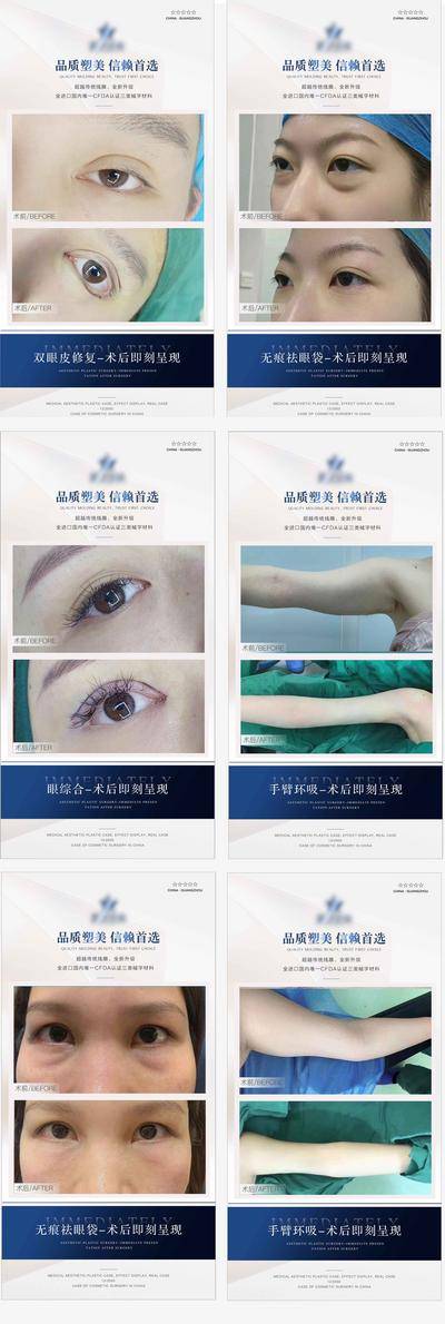 【南门网dcpsd.com】海报 医美 整形 案例 模板 对比 简约