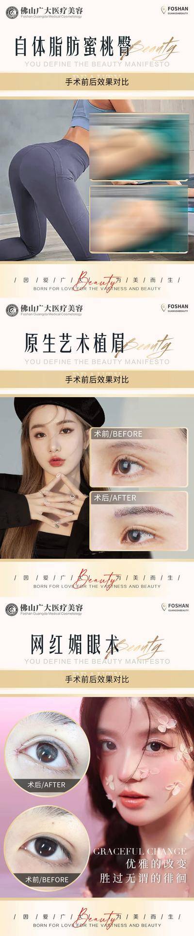 【南门网dcpsd.com】海报 医美 整形 案例 对比 简约 人物 脂肪 眼综合 面部填充 眼部