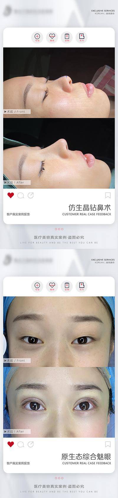 【南门网dcpsd.com】海报 医美 案例 模板 鼻子 眼睛 案例对比