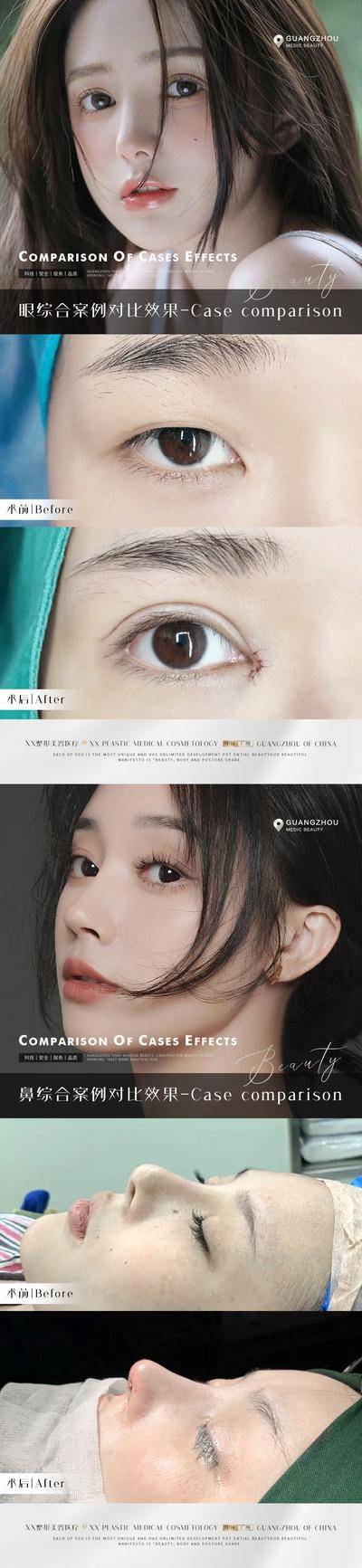 【南门网dcpsd.com】海报 医美 美容 美业 案例 对比 眼综合 鼻综合
