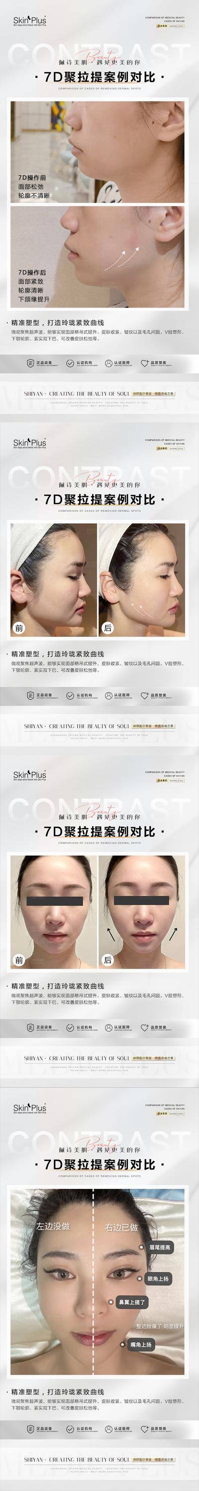 【南门网dcpsd.com】海报 医美 整形 7D聚拉提 抗衰 逆龄 案例 对比