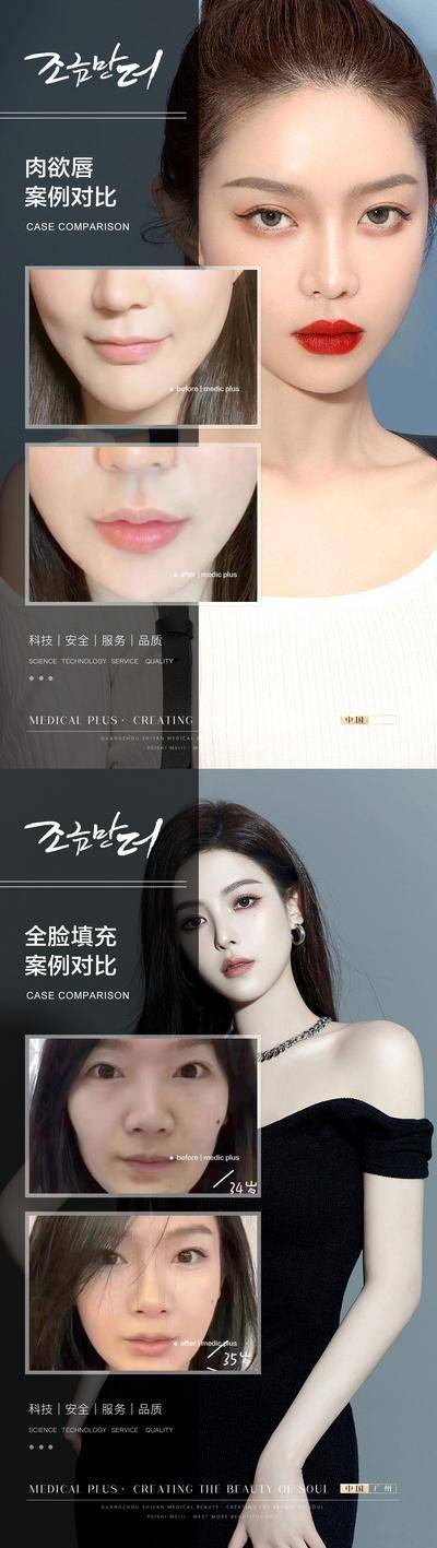 【南门网dcpsd.com】海报 医美 整形 案例 对比 人物 唇部 全脸 填充