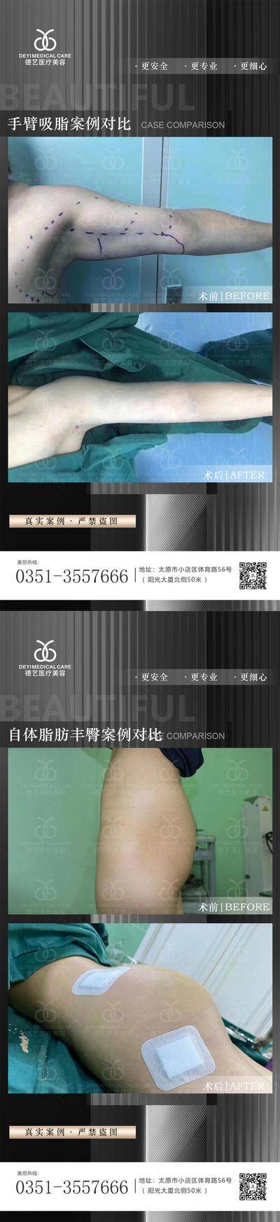 【南门网dcpsd.com】海报 医美 案例 对比 黑金 系列