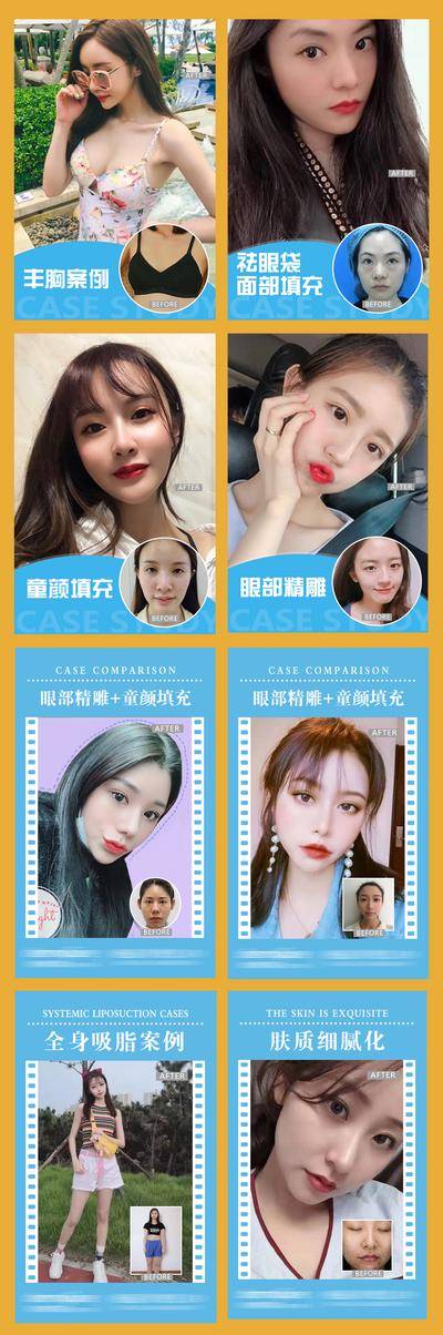 【南门网dcpsd.com】海报 美容 医美 整形 案例对比 人物