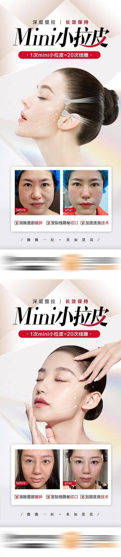 【南门网dcpsd.com】海报 医美 整形 项目 小拉皮 抗衰 对比