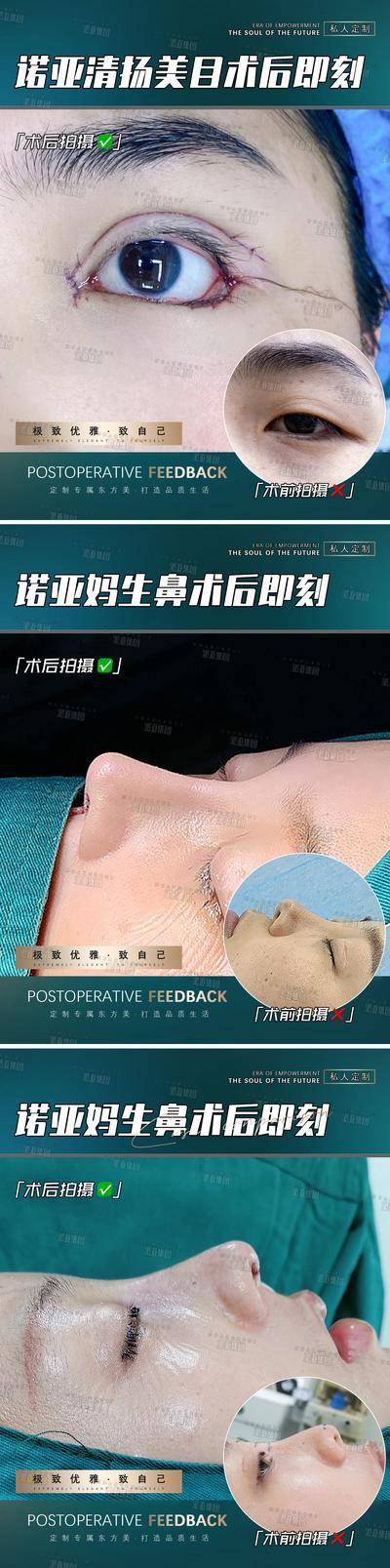 【南门网dcpsd.com】海报 医美 整形 案例 对比
