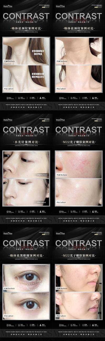 【南门网dcpsd.com】海报 医美 整形 美容 案例 嗨体祛颈纹 黑眼圈 水光针 光子嫩肤 对比 系列