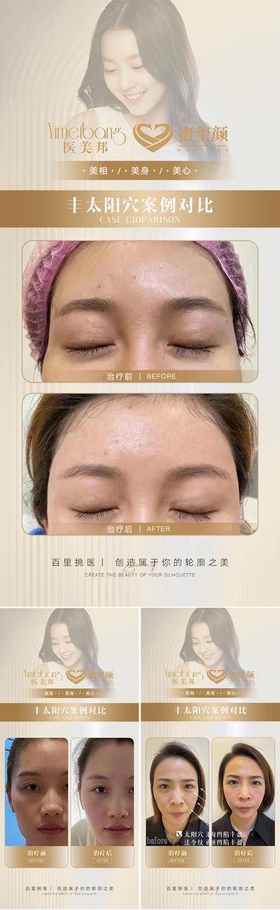 【南门网dcpsd.com】海报 医美 整容 光子 嫩肤 仪器 人物