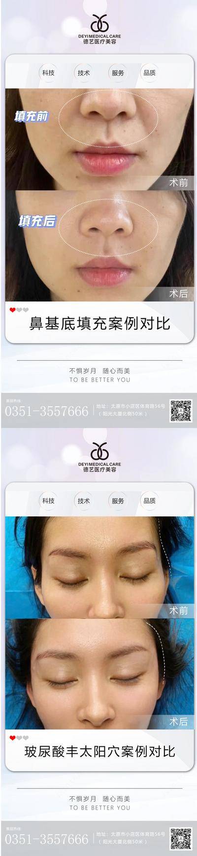 【南门网dcpsd.com】海报 医美 案例 对比图 人物 简约