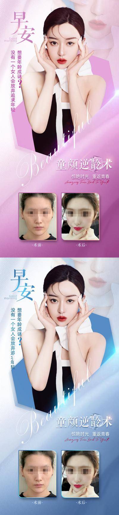 【南门网dcpsd.com】海报 整形 医美 早安图 案例 对比 水光针 玻尿酸