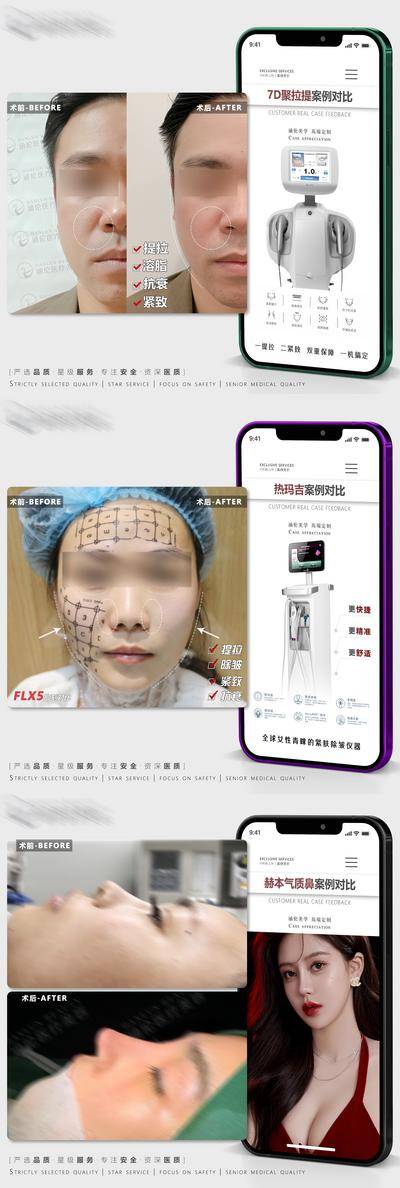 【南门网dcpsd.com】海报 医美 美容 整形 7D聚拉提 热玛吉 鼻综合 案例对比 手机