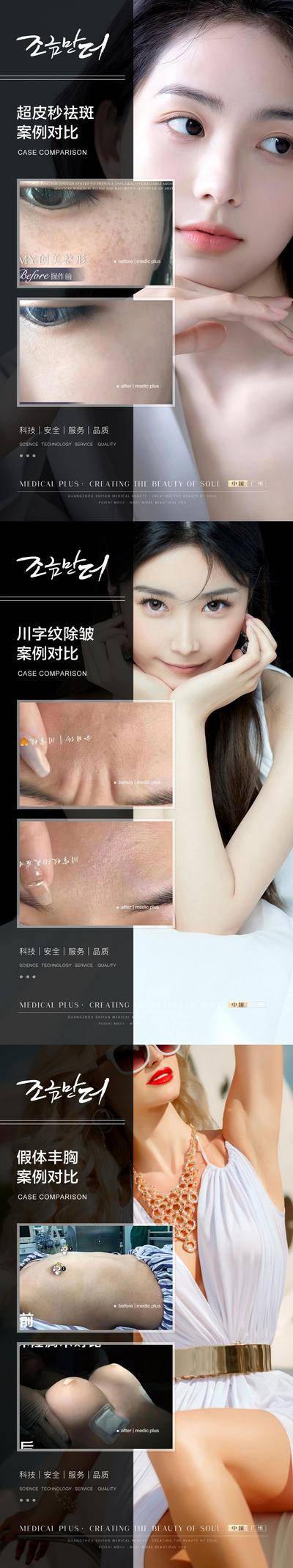 【南门网dcpsd.com】海报 医美 案例 对比 人物 简约