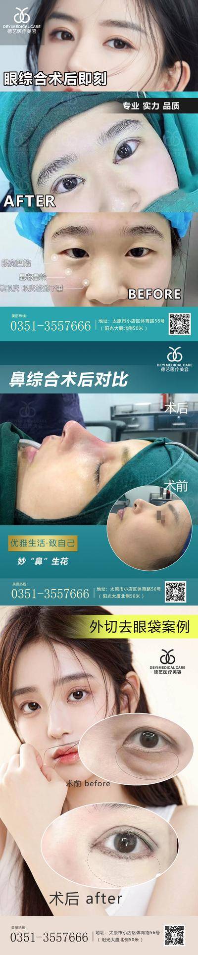 【南门网dcpsd.com】海报 医美 整形 案例 对比 人物 祛抬头纹 玻尿酸 填充