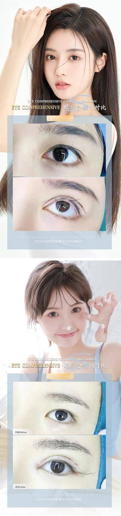 【南门网dcpsd.com】海报 医美 整形 眼综合 双眼皮 人物 案例 对比 系列