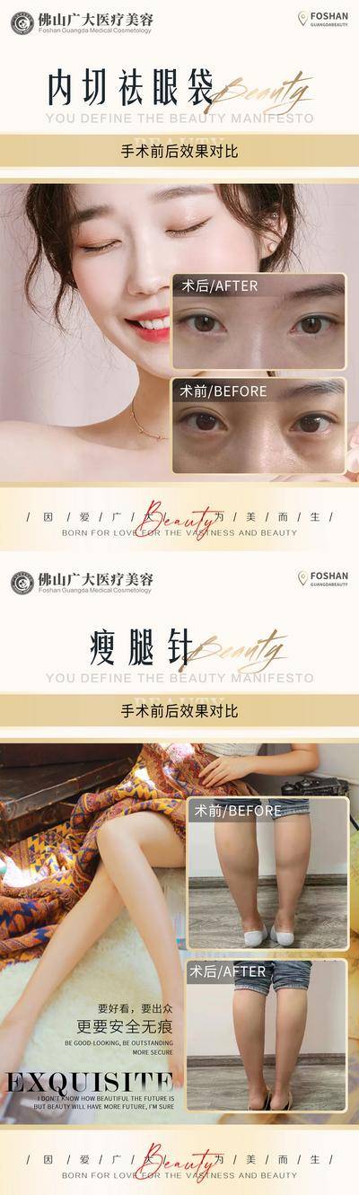 【南门网dcpsd.com】海报 医美 整形 案例 对比 简约 人物 祛眼袋 瘦腿 微创
