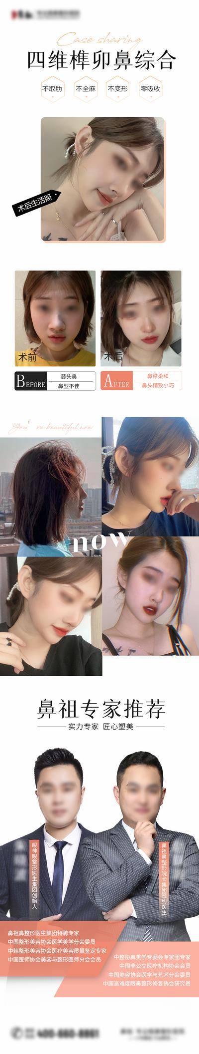 【南门网dcpsd.com】海报 长图 医美 整形 美鼻 隆鼻 案例 对比 专家