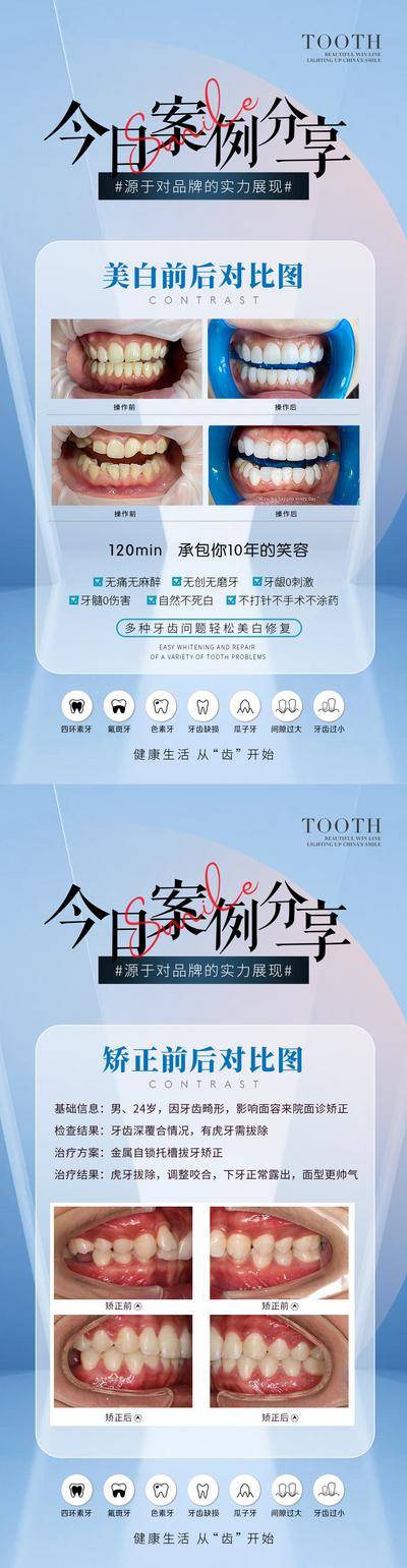 【南门网dcpsd.com】海报 口腔 医疗 牙科 牙齿 案例 对比图 美白 矫正 贴面