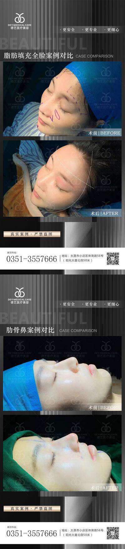 【南门网dcpsd.com】海报 医美 案例 对比图 人物 项目