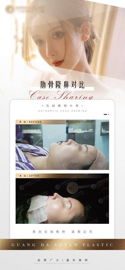 【南门网dcpsd.com】海报 医美 隆鼻 案例 对比 人物