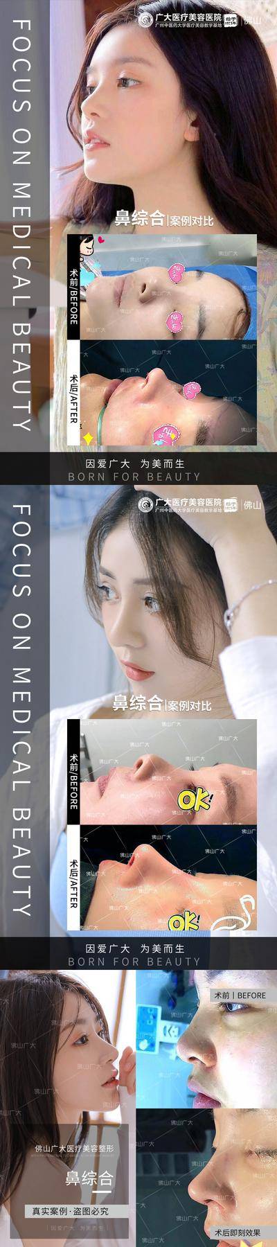 【南门网dcpsd.com】海报 医美 整形 案例 对比 人物 泪沟 修复 祛斑 淡斑 纹绣 纹眉