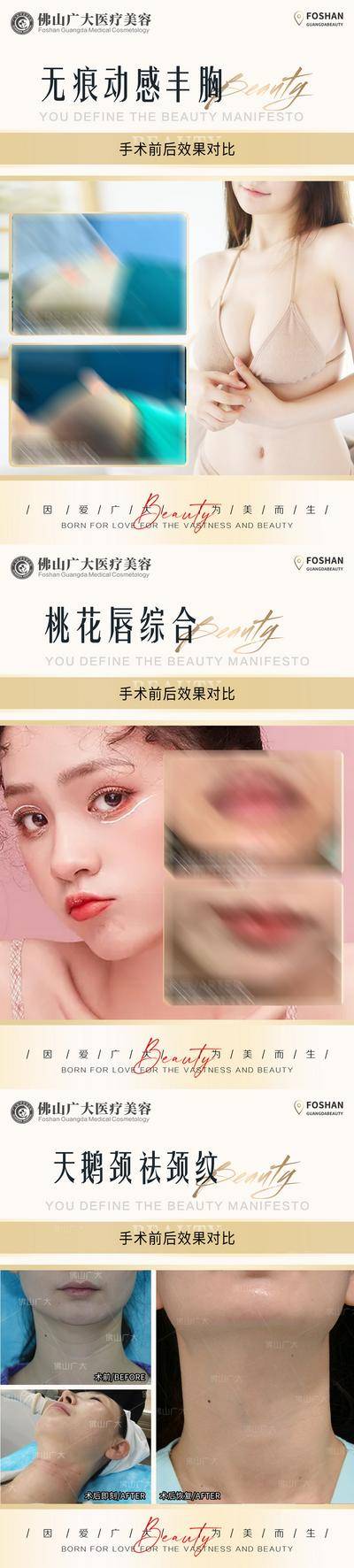 【南门网dcpsd.com】海报 医美 整形 案例 对比 简约 人物 丰胸 唇 天鹅颈 简约 系列