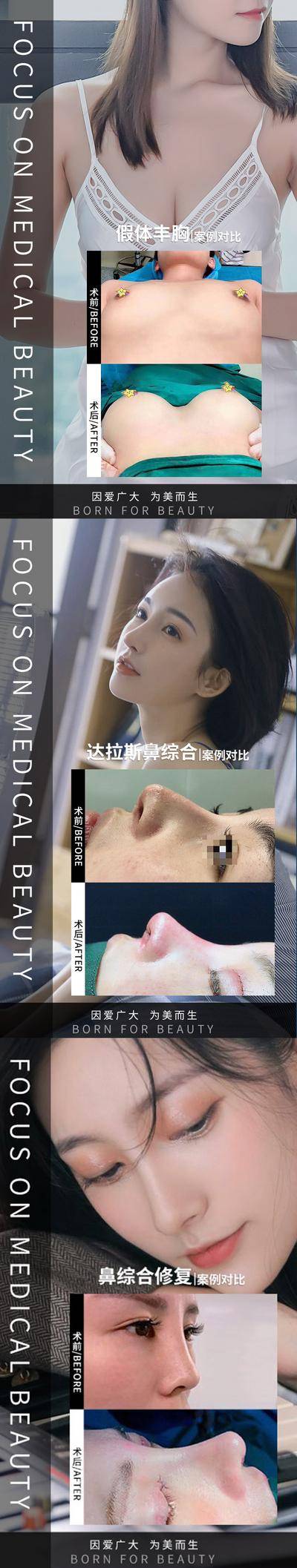【南门网dcpsd.com】海报 医美 真人案例 对比  丰胸 隆胸 鼻综合 