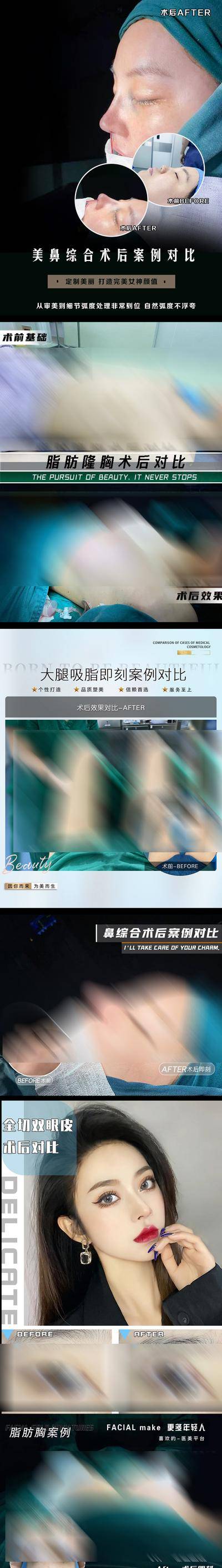【南门网dcpsd.com】海报 医美 整形 案例 对比 隆鼻 双眼皮 丰胸 吸脂