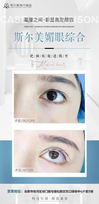 【南门网dcpsd.com】海报 医美 美眼 眼综合 案例 对比