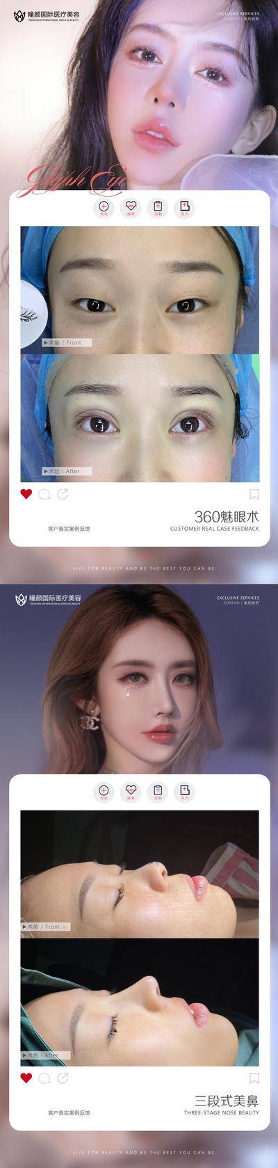 【南门网dcpsd.com】海报 医美 人物 美业 案例 对比