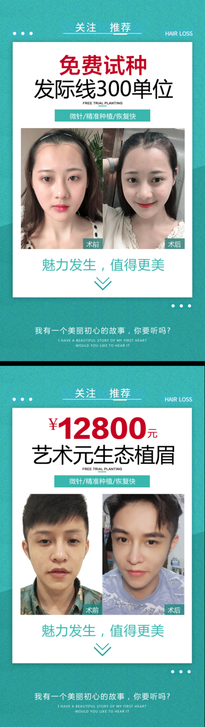 【南门网dcpsd.com】海报 医美 整形 植发 发际线  案例 对比 