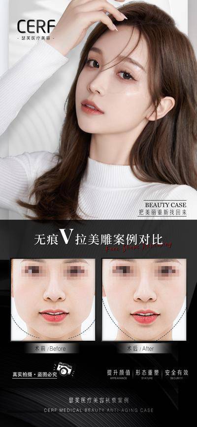 【南门网dcpsd.com】广告 海报 医美 人物 高端 热销 案例 对比