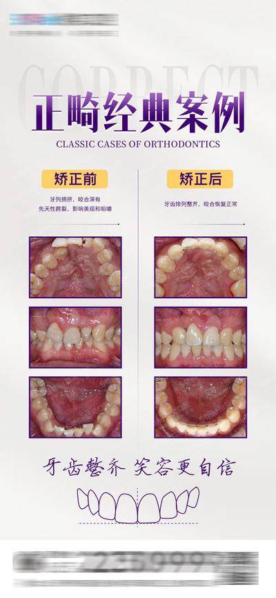 【南门网dcpsd.com】海报 医美 正畸 口腔 案例对比 牙齿 矫正 牙齿线稿 种植牙