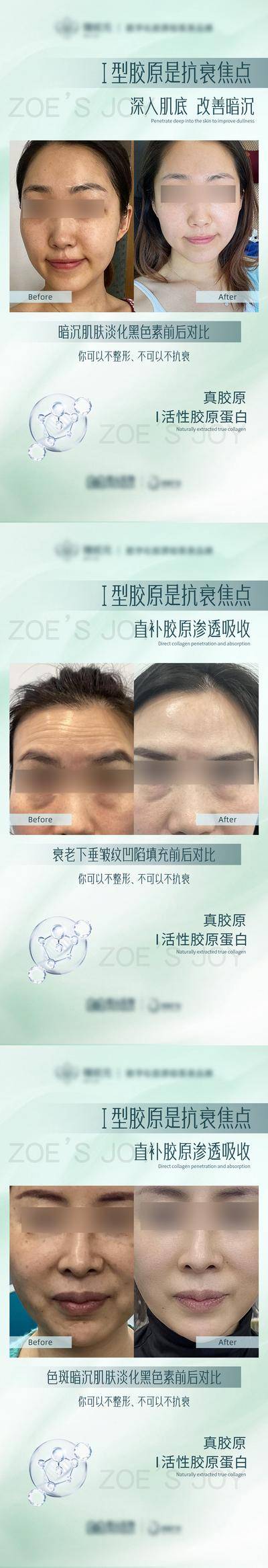 【南门网dcpsd.com】广告 海报 医美 案例 对比 整形 美容 系列