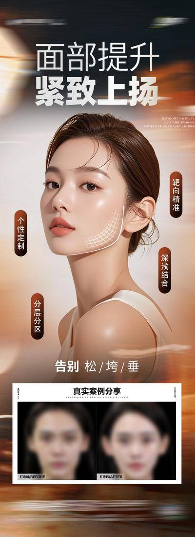 【南门网dcpsd.com】广告 医美 高端 抗衰 质感 创意 模特 医院 美业 整形 美容 版式 排版 大气 高级 气质 宣发 面部提升 案例 对比 紧致 提拉 面部提拉 抗衰 年轻化 幼态脸