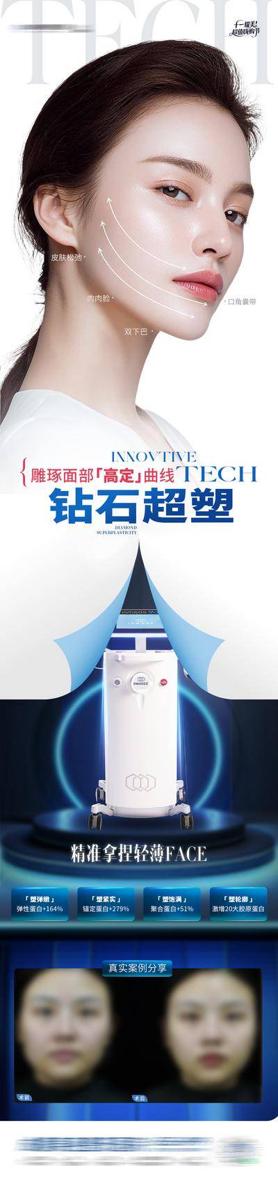 【南门网dcpsd.com】广告 医美 高端 仪器 质感 创意 钻石超塑 全面部 案例 对比 抗衰 提升 瘦脸 紧致 皮肤 精雕 轻薄脸 轮廓 饱满 紧实 嫩肤 卷页 模特 整形 美容 气质 时尚 版式 排版 大气 宣传