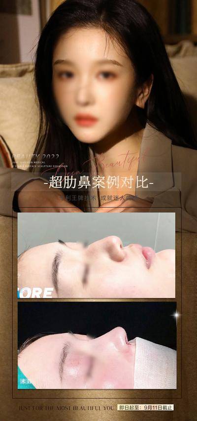 【南门网dcpsd.com】海报 医美 活动 隆鼻 人物 促销 美容 皮肤 案例 对比