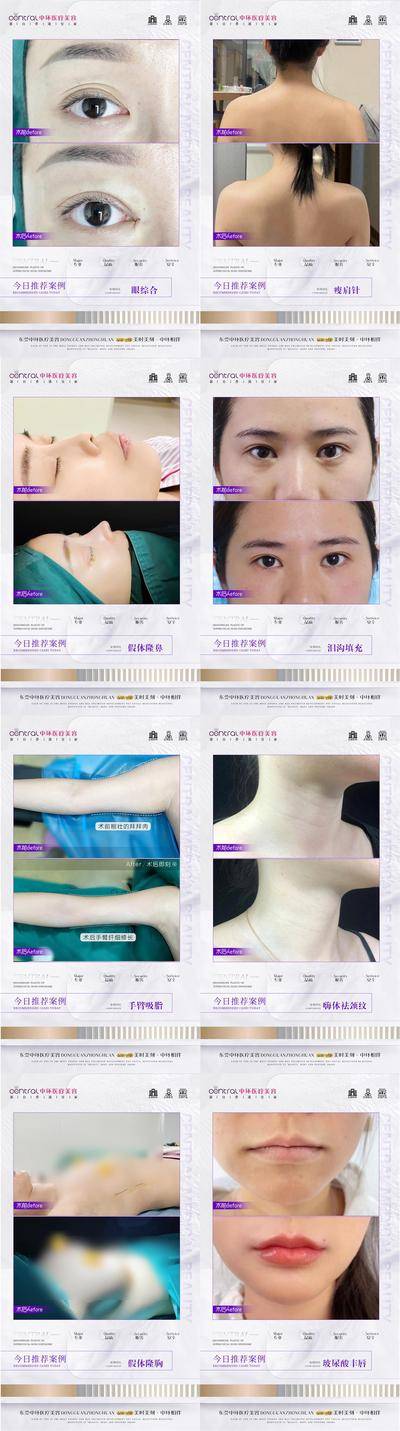【南门网dcpsd.com】海报 医美 人物 案例 对比 隆鼻 隆胸 手臂吸脂 整形 