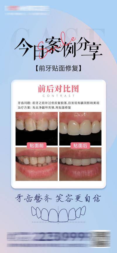 【南门网dcpsd.com】海报 医美 口腔 案例 分享 对比 牙齿 齿科 贴面 美白 牙齿线稿 简约 大气