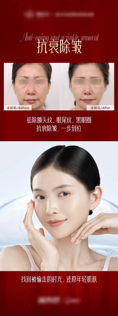 【南门网dcpsd.com】广告 海报 医美 人物 案例 对比 易拉宝 除皱