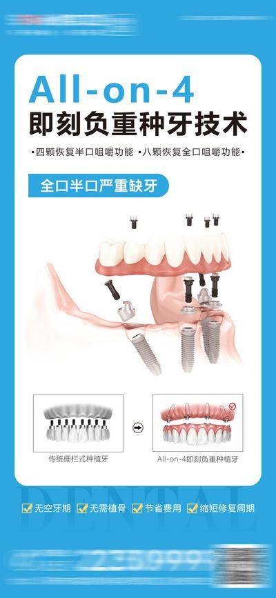 【南门网dcpsd.com】广告 海报 医美 口腔 种植牙 牙科 齿科 即刻负重 牙齿 大气 简约 对比图