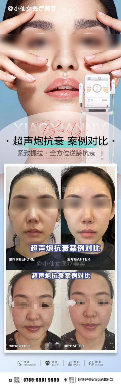 【南门网dcpsd.com】海报 长图 医美 超声炮 案例对比 逆龄 抗衰 仪器 设备 提拉