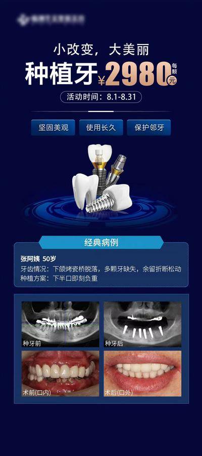 【南门网dcpsd.com】广告 海报 医美 种植牙 案例 对比 病例 邻牙 美丽 缺失 口腔 牙齿 爆款 价格