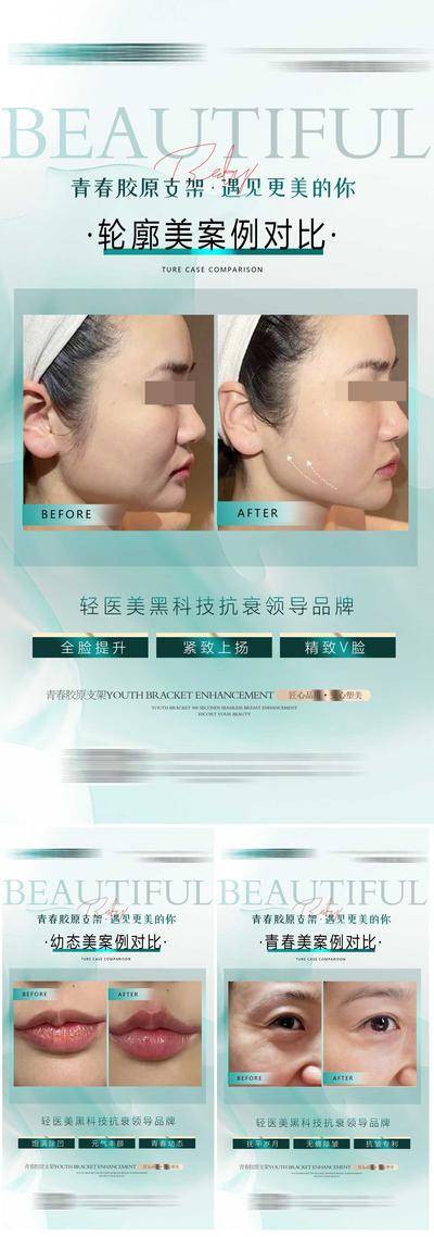 【南门网dcpsd.com】广告 海报 医美 轮廓 轻医美 年轻 简洁 案例 品项 宣传 对比