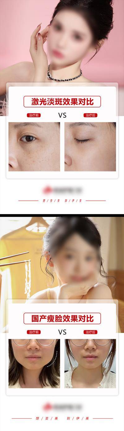 【南门网dcpsd.com】广告 海报 医美 案例 对比 任务 效果 祛斑 淡斑 瘦脸