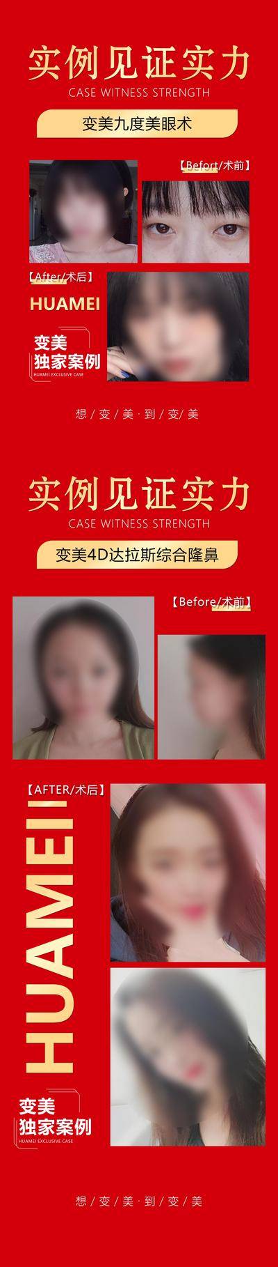 【南门网dcpsd.com】广告 海报 医美 案例 海报 长图 医美 实力 见证 案例 对比 眼鼻 达拉斯 综合 隆鼻 独家 变美 到院