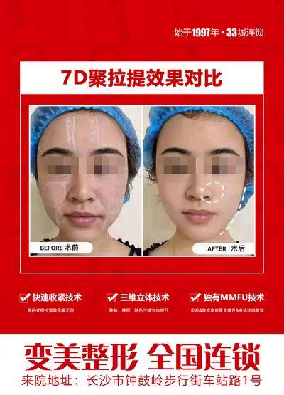 【南门网dcpsd.com】海报 医美 7D 聚拉提 效果 对比 无痛 无创 肌肤 立体 认证 核心 技术 投影 模糊