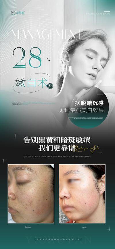 【南门网dcpsd.com】广告 海报 医美 人物 案例 对比 护肤