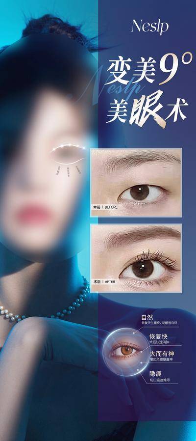 【南门网dcpsd.com】广告 海报 医美 美眼术 线条 光效 案例 对比 自然 恢复快 创伤 外科 优点 模特 美女 蓝光