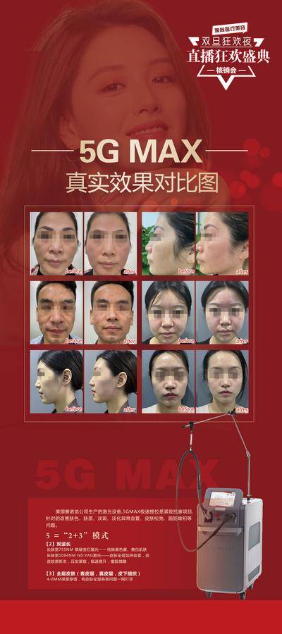 【南门网dcpsd.com】广告 海报 医美 案例 对比 灯箱 红色海报 直播海报 喜庆 春节